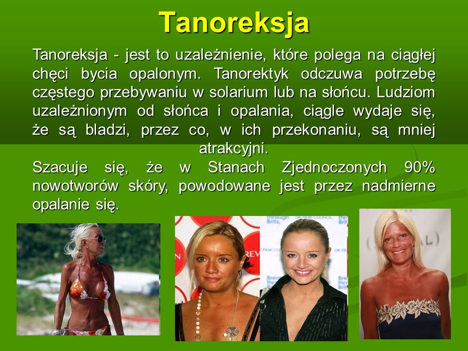 Tanoreksja Tanoreksja - jest to uzależnienie, które polega na ciągłej chęci bycia opalonym.