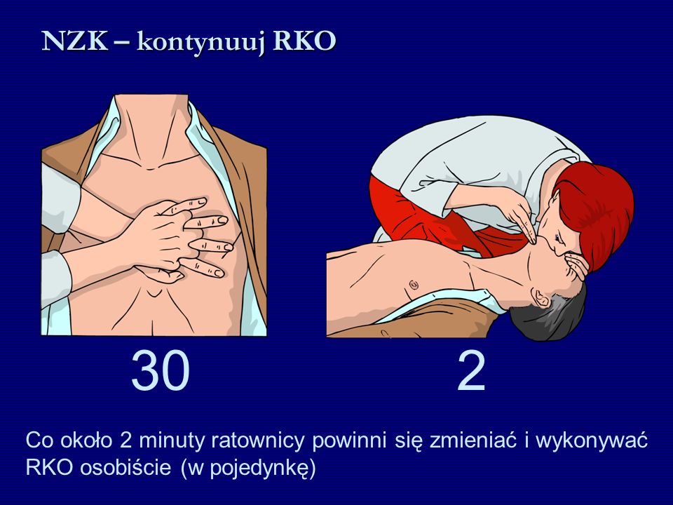 NZK – kontynuuj RKO 30 2 Co około 2 minuty ratownicy powinni się zmieniać i wykonywać RKO osobiście (w pojedynkę)